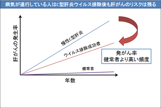 病気が進行している人はC型肝炎ウイルス排除後も肝がんのリスクは減る