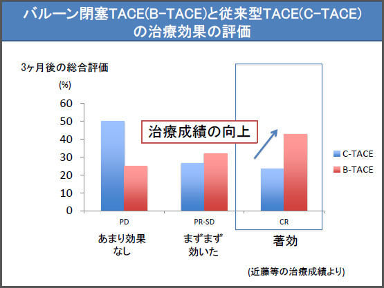 バルーン閉塞(B-TACE)と従来型TACE(C-TACE)の治療効果の評価