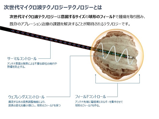 次世代マイクロ波テクノロジーテクノロジーとは