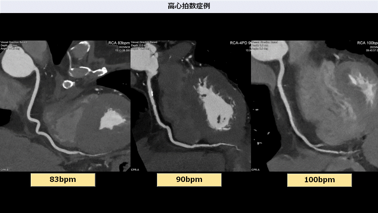 症例1