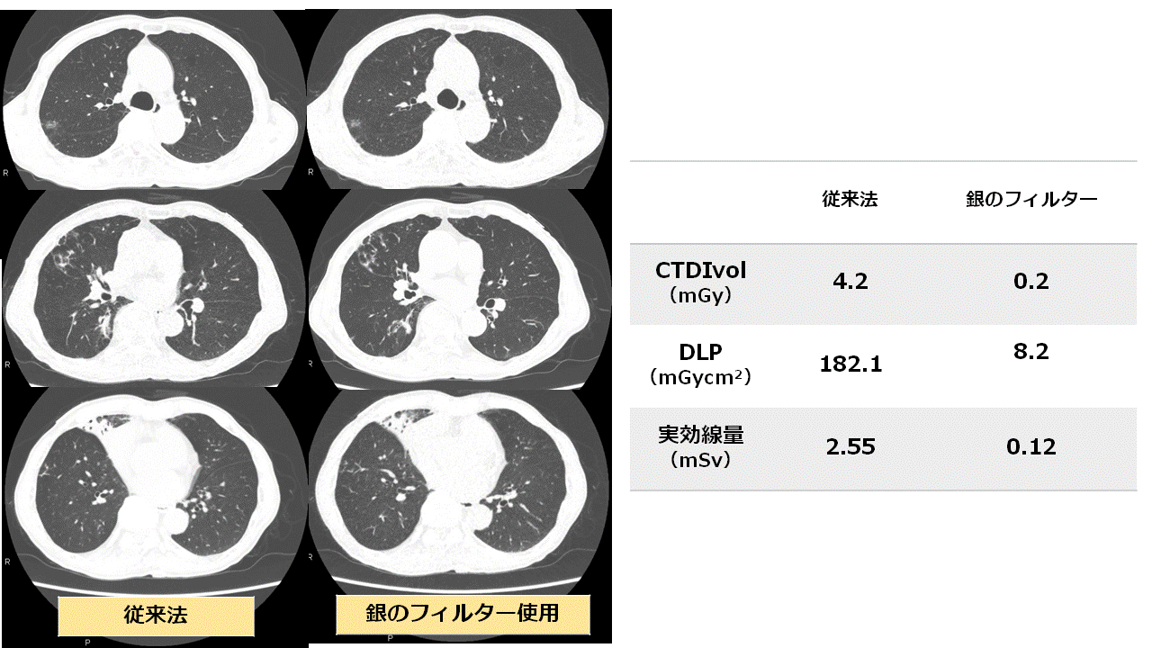 症例5